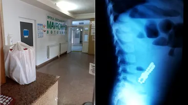 Trei copii din Botoșani, operați de urgență după ce au ajuns la spital cu perforații la nivelul intestinului: “Acești magneți sunt foarte puternici”. Semnalul de alarmă tras de medici