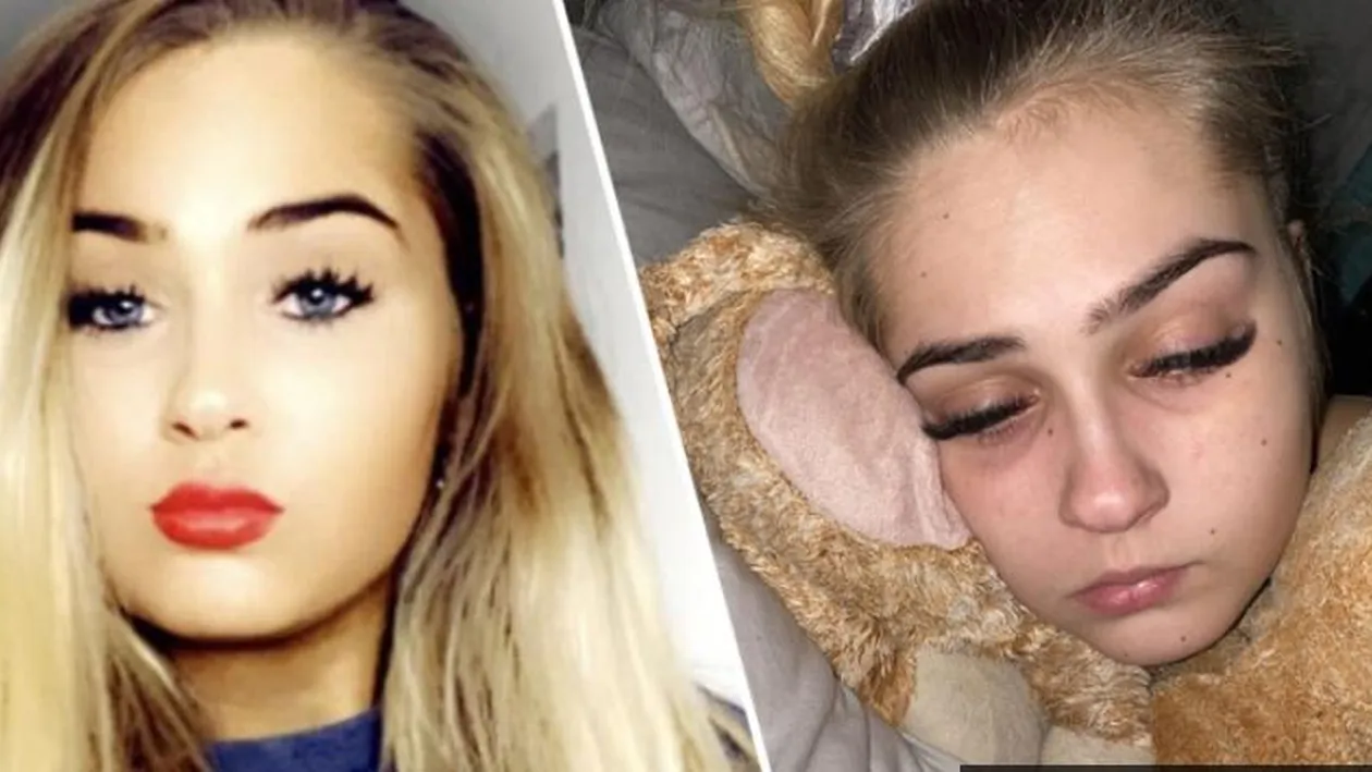 O copilă de 16 ani este ”prinsă” în corpul unei bătrâne de 80 de ani. Ce boală cumplită îi macină trupul