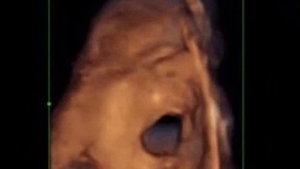 Vei fi emotionat pana la lacrimi! Imagine incredibile cu bebelusii care "canta si danseaza" in uterul mamei!