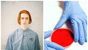 Bărbaţii tineri, cei mai afectaţi de variola maimuţei! Sute de cazuri în întreaga lume