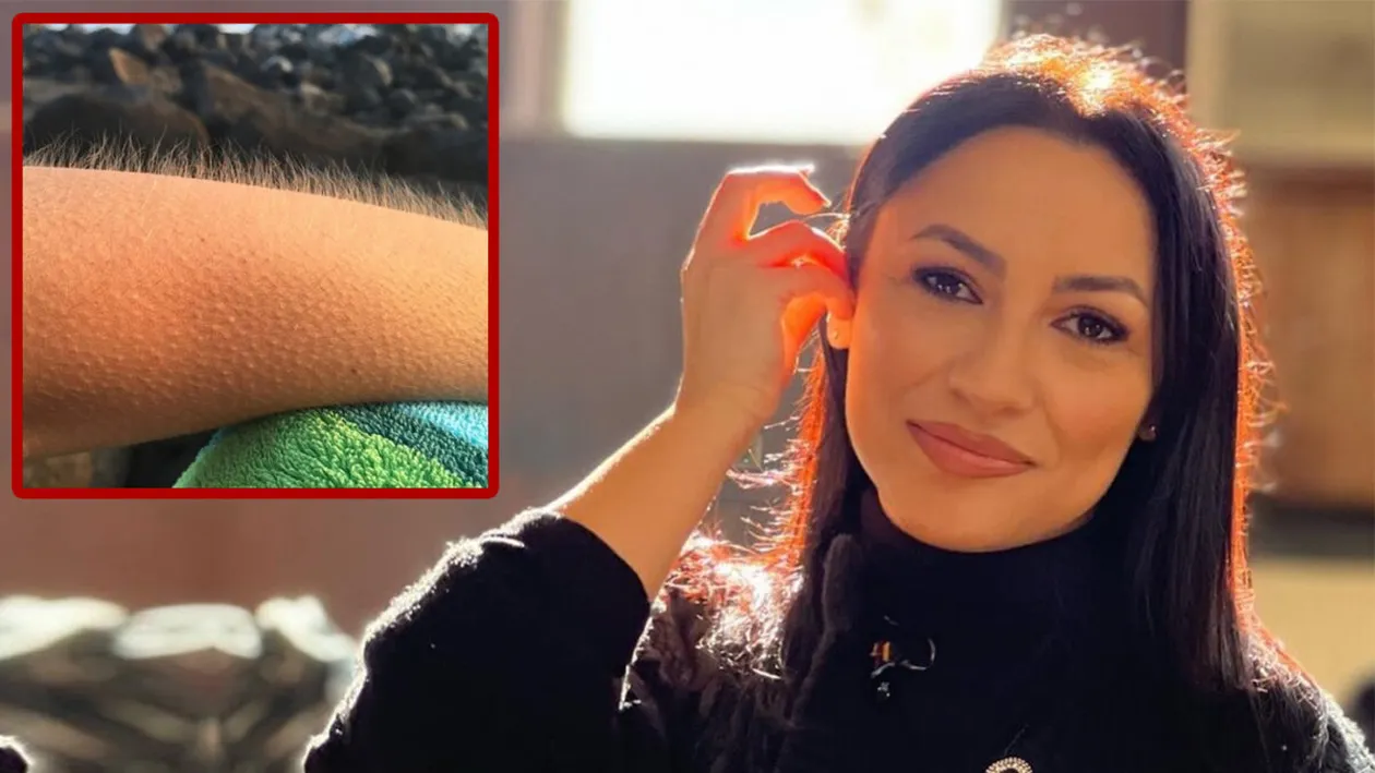 Ce este pielea de găină, de fapt. Explicațiile oamenilor de știință