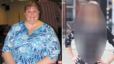 Transformarea INCREDIBILA a unei femei care a slabit 83 de kg intr-un an: Nu mai suportam sa ma uit in oglinda Vezi cum arata