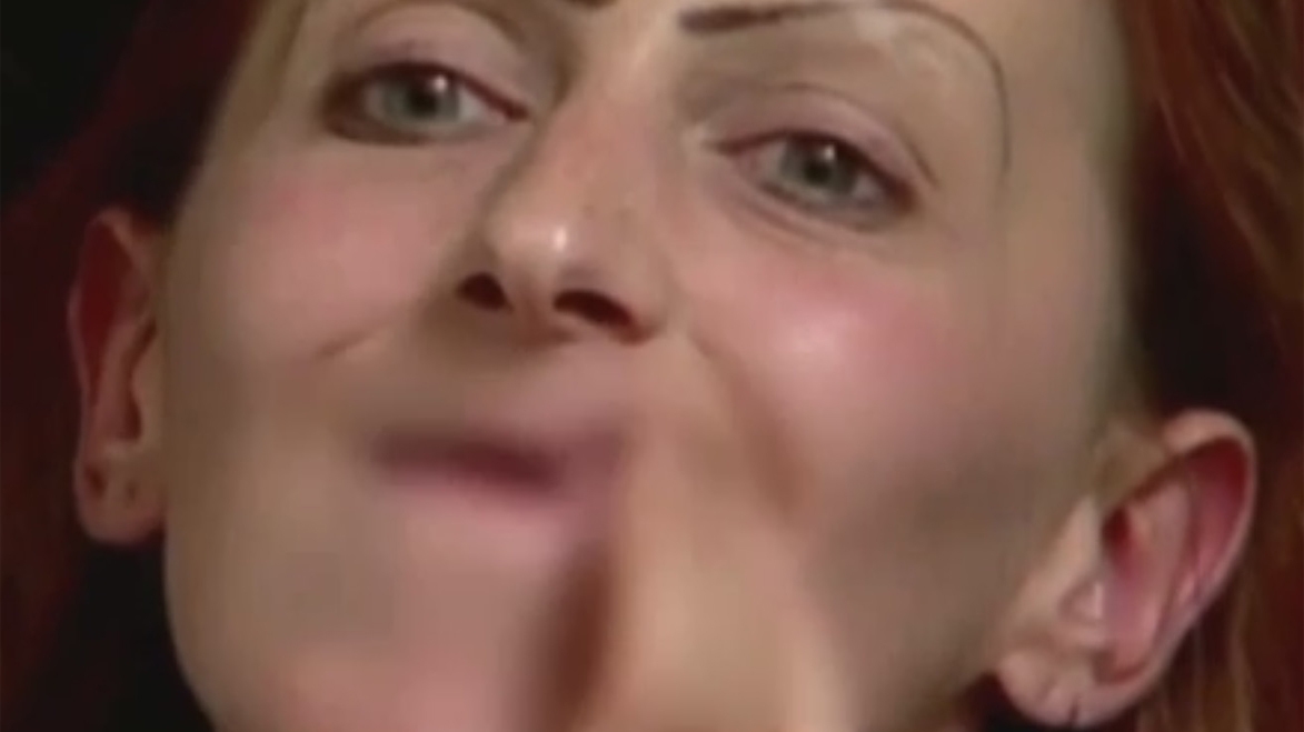 O mai ştiţi pe GABRIELA? Cum arată după 5 ani de la operaţie femeia supranumită şi „Moartea în vacanţă“