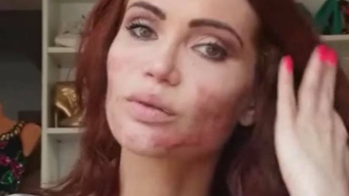 Maria Ilioiu a rămas mutilată după o intervenție estetică