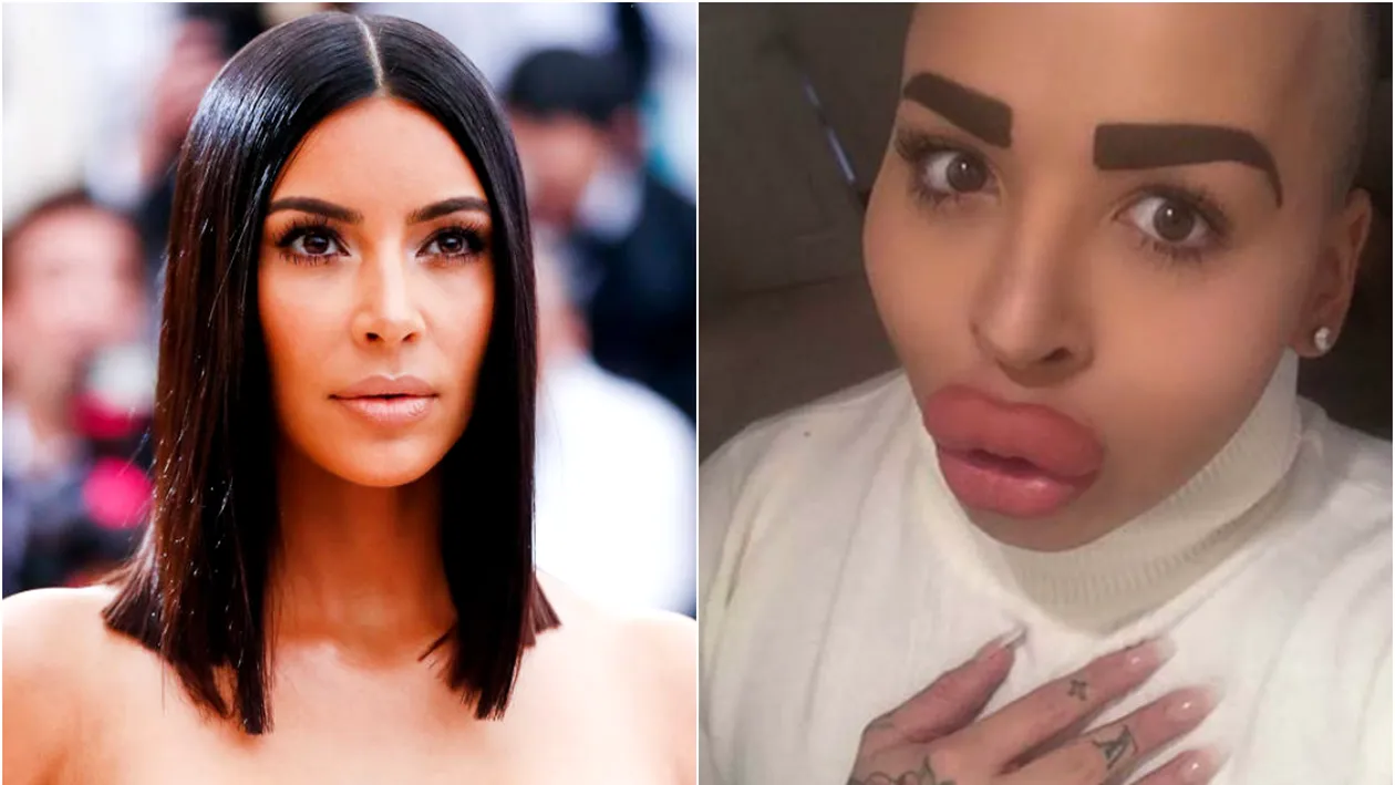 Acest tânăr de 23 de ani a cheltuit 150 de mii de dolari pentru a arăta precum KIM KARDASHIAN