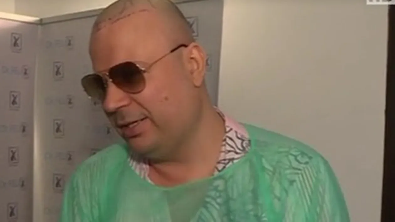 DAN HELCIUG le-a arătat tuturor marea schimbare! Cum arată după ce şi-a făcut implant de păr