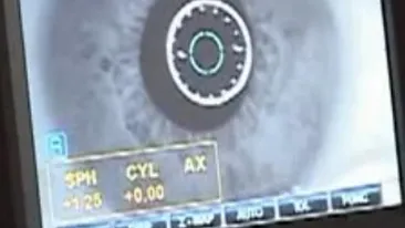 INCREDIBIL! Un vierme de 10 centimetri a crescut in ochiul unui barbat! VEZI cum a ajuns acolo!