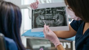 (P) Ce trebuie să știi despre radiologia dentară: tipuri, tarife și utilitatea ei în stomatologie