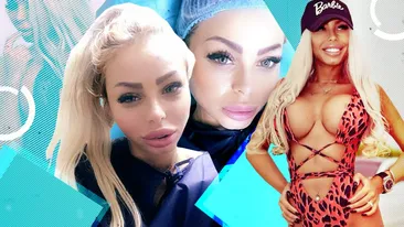 Fosta soție a fotbalistului de națională și-a scos grăsimea din obraji. Avem primele imagini după operație