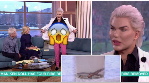 Rodrigo Alves si-a scos COASTELE! Cum arata acum Papusa Umana Ken si de ce a facut-o. Motivul este ireal de STUPID!!!