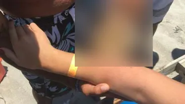 Cel mai ciudat accident întâlnit vreodată! O femeie a ajuns la spital cu un rechin prins de braţ. „Niciodată nu am văzut aşa ceva“