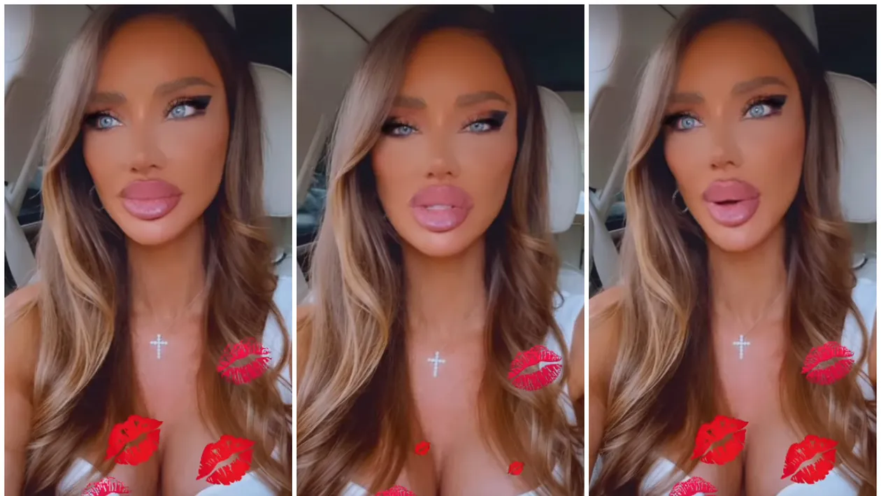Bianca Drăgușanu, pusă la zid din cauza buzelor prea mari. Reacția neașteptată a vedetei: ”De asta mi-am făcut atâtea operații estetice”