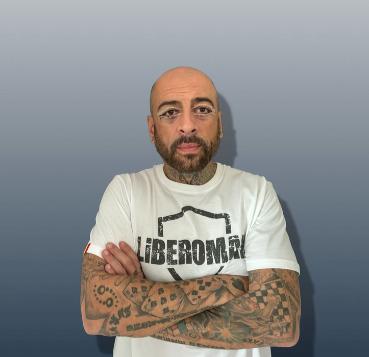 Ochii lui CRBL s-au învinețit după operație. Foto: Instagram / CRBL