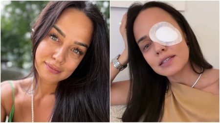 Andreea Raicu a apărut cu un ochi bandajat! Ce a pățit vedeta: „E ceva îngrozitor. E al naibii de dureros”