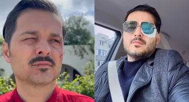Liviu Vârciu, de urgență la spital după ce a suferit un accident: ”M-a ferit Dumnezeu, că puteam să fiu...”