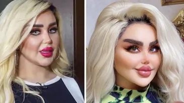 Dalia a vrut să arate ca păpușa Barbie, dar rezultatul i-a șocat pe apropiați. După 43 de operații, tânăra de 30 de ani este asemănată cu un zombi