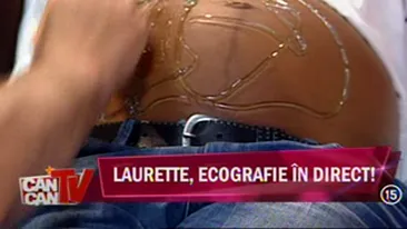 VIDEO PREMIERA! Ecografie in direct! Laurette si-a vazut copilul nenascut pe post!