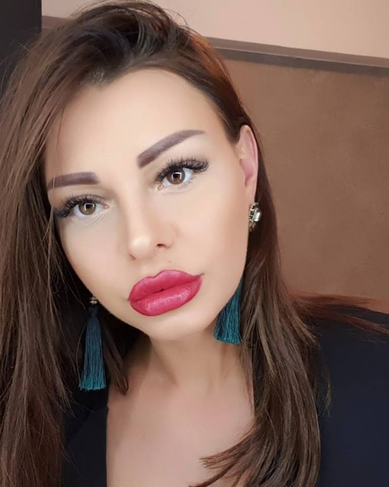 Ana Mocanu, diagnostic crunt: ”Este o boală infecţioasă care provoacă deces”