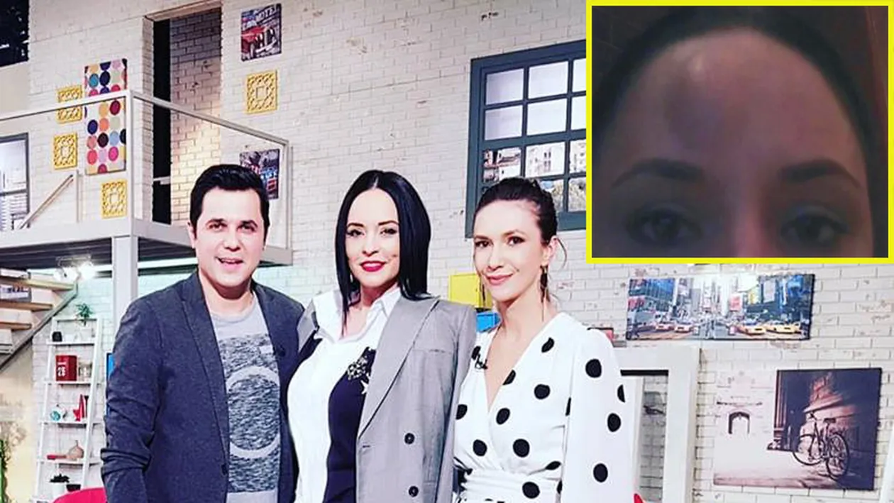 Andreea Marin, într-o ipostază neplăcută. Imaginile în care vedeta are un cucui în frunte, mare cât un ou: Am văzut la propriu stele verzi