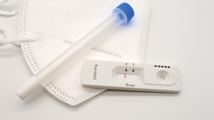 Coronavirus România, 3 aprilie. Aproape 5500 de cazuri noi SARS – CoV – 2, înregistrate în ultimele 24 de ore