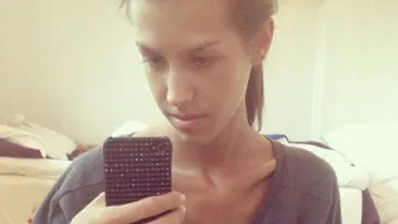 Era atat de slaba incat oamenii se speriau de ea! Cum arata dupa ce a stat doua luni in spital si s-a insanatosit