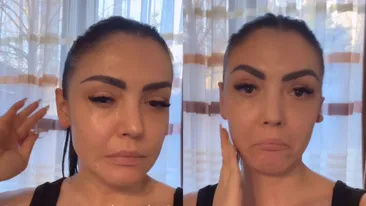 Ce truc folosește Andreea Mantea ca să își dezumfle fața. Așa ceva... „Doare un pic!”
