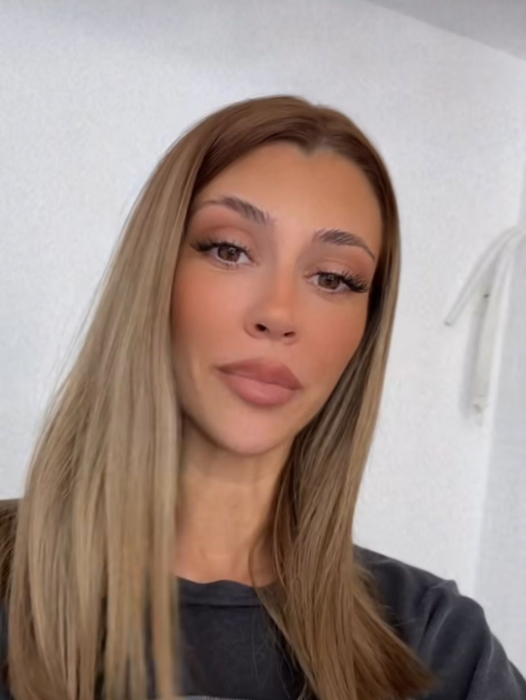 Mădălina de la Insula iubirii, intervenţie neaşteptată la nivelul feţei. Cum arată acum, după ce şi-a scos acidul din buze