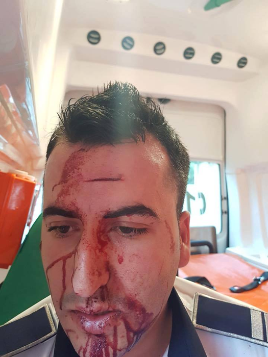 Poliţist lovit cu un telefon în cap, în trafic, la Craiova