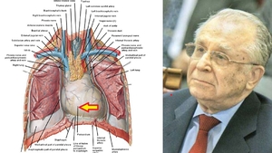Ce este, de fapt, pericardita hemoragică, boala cu care a fost diagnosticat Ion Iliescu