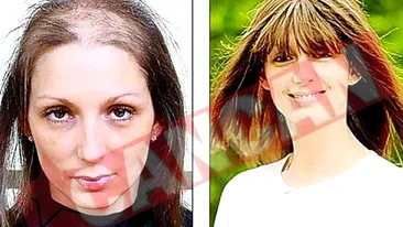 Isi smulge parul de pe cap de 16 ani