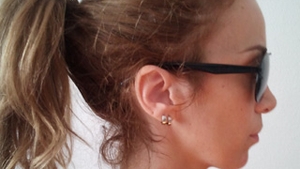 Annes a fost arsa pe gat cu ondulatorul de catre hair stylista! Cantareata se trateaza acum cu sange de vitel!