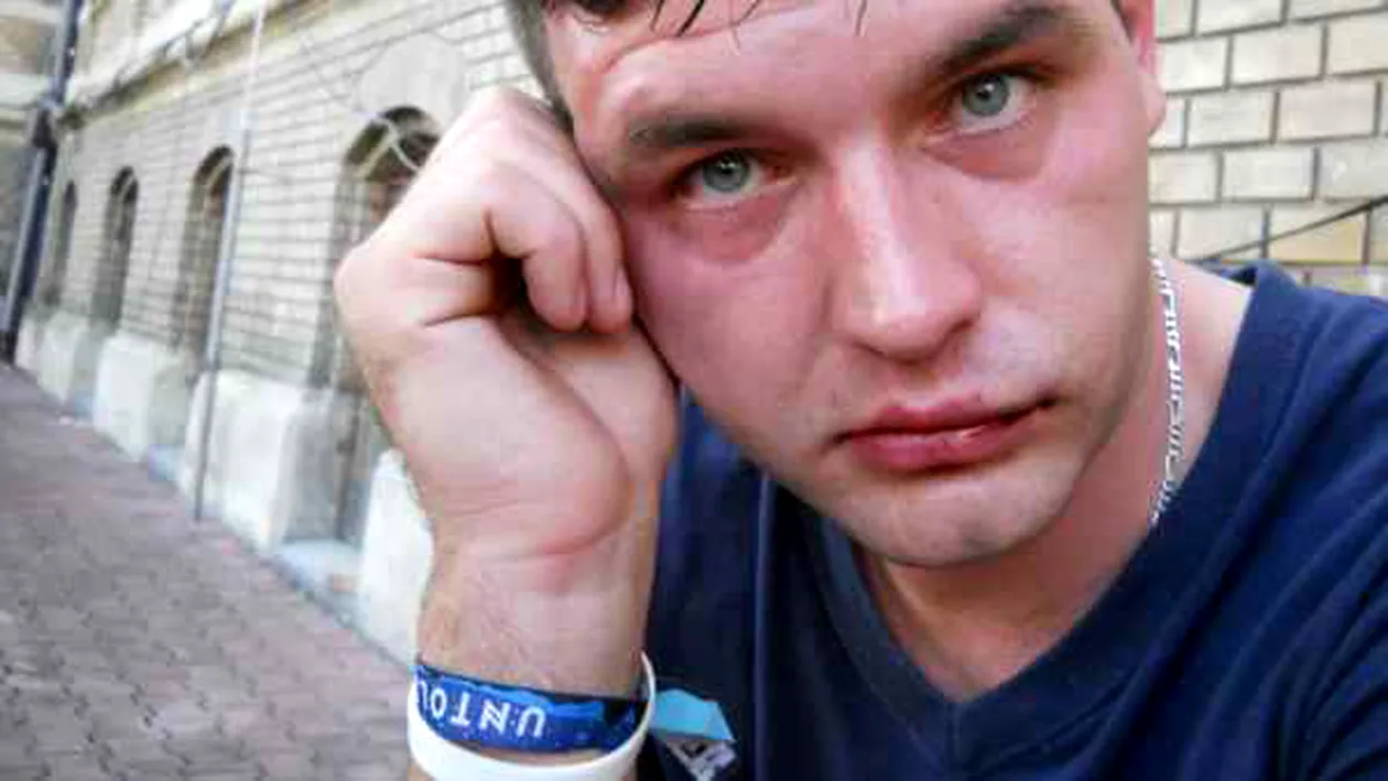 Bătut cu sălbăticie la festivalul UNTOLD. Victima, un român stabilit la Londra. Martorii susţin că era beat şi agresiv
