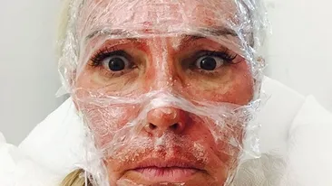 Natascha Ochsenknecht a vrut să scape de riduri, dar a ajuns DESFIGURATĂ! Imagini terifiante după tratamentul de înfrumuseţare!