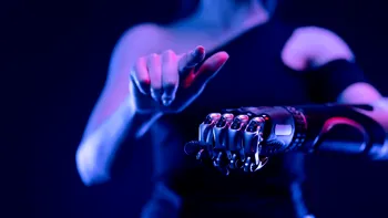 Românul cu mâna de Robocop. Vă spunem povestea unei minuni tehnologice și a unei umilințe fiscale de acum 20 de ani