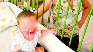Copilul torturat de mama va fi dat in plasament! L-a ars cu un cutit incins pe fata