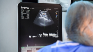 Recoltare complet laparoscopică, pentru un nou transplant hepatic  realizat cu succes la SANADOR