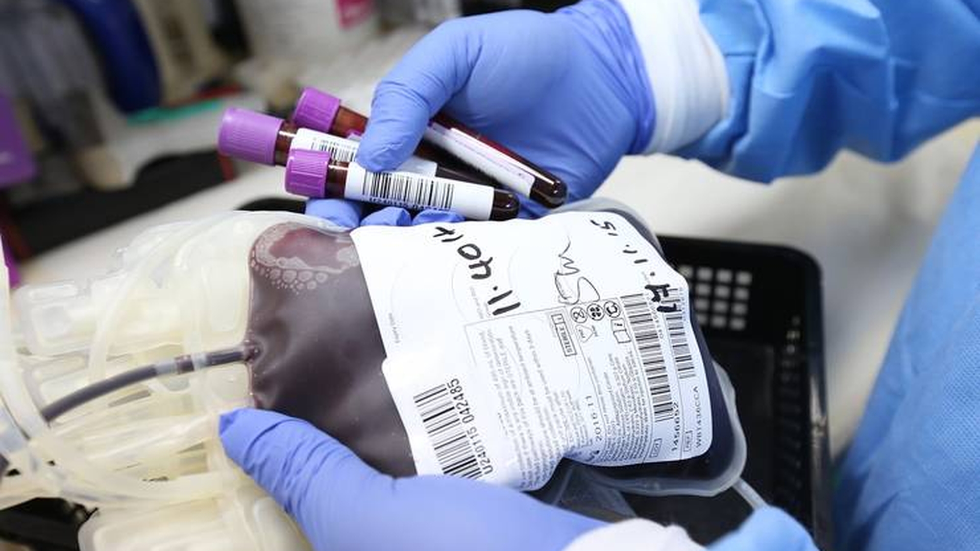 Vestea pe care o așteptau bolnavii de COVID-19: tratamentul cu plasmă reduce rata mortalității