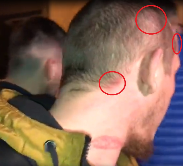 What’s Up, primele imagini după ce a fost audiat în urma scandalului cu iubita lui! Artistul are mai multe răni pe corp