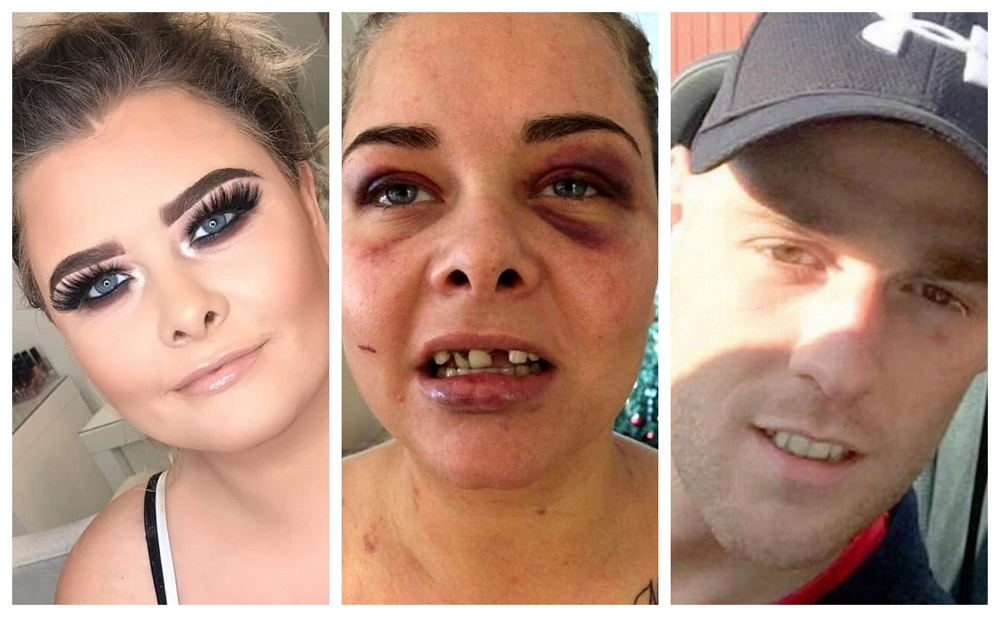 Un bărbat și-a bătut iubita și i-a spart trei dinți din cauză că a schimbat poza de pe Facebook și el nu mai apărea în ea