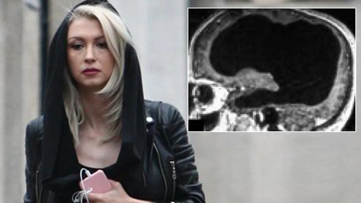 Andreea Bălan, complicații după stop-cardiac. A fost creierul afectat?! Am făcut două RMN-uri