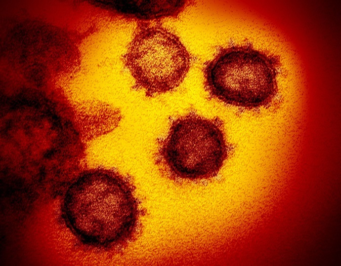 epa08252658 An undated handout picture made available by the National Institutes of Health (NIH) shows a transmission electron microscope image of SARS-CoV-2 -- also known as 2019-nCoV, the virus that causes COVID-19 -- isolated from a patient in the USA, emerging from the surface of cells cultured in the lab (issued 27 February 2020). The novel coronavirus is on the verge of spreading across the world as more cases are emerging outside China with outbreaks in South Korea, Italy and Iran.  EPA/NIAID- RML/NATIONAL INSTITUTES OF HEALTH HANDOUT  HANDOUT EDITORIAL USE ONLY/NO SALES