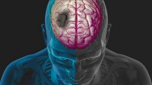 Ce-i omoară pe români? Avertisment din partea unui celebru neurolog