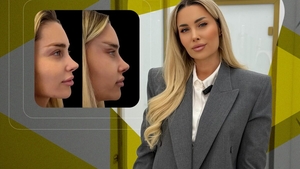 Oana Monea spune adevărul despre operațiile estetice care au scandalizat internetul: "Nu mi-am ridicat fața!"