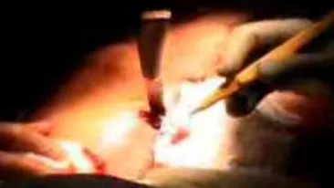 Imagini cutremuratoare! Uite cum se chinuie medicii sa ii scoata cutitul din inima!