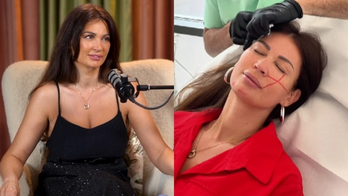 Nicoleta Luciu, din nou la estetician! Ce modificare și-a făcut la nivelul feței