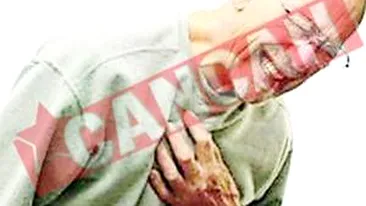 Mimeaza atacurile de cord ca sa nu plateasca