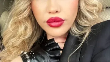 Vedeta din România care a suferit 5 operații în șase ani de chin, după un Hollywood smile: „Am început să fac infecții la rădăcină”