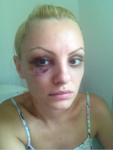 Alexandra Stan, dezvăluiri despre bătaia pe care a primit-o de la Marcel Prodan. " Ca să ajungi agresor, ai și tu niște probleme emoționale… " + Cum a reușit să depășească perioada neagră din viața ei 