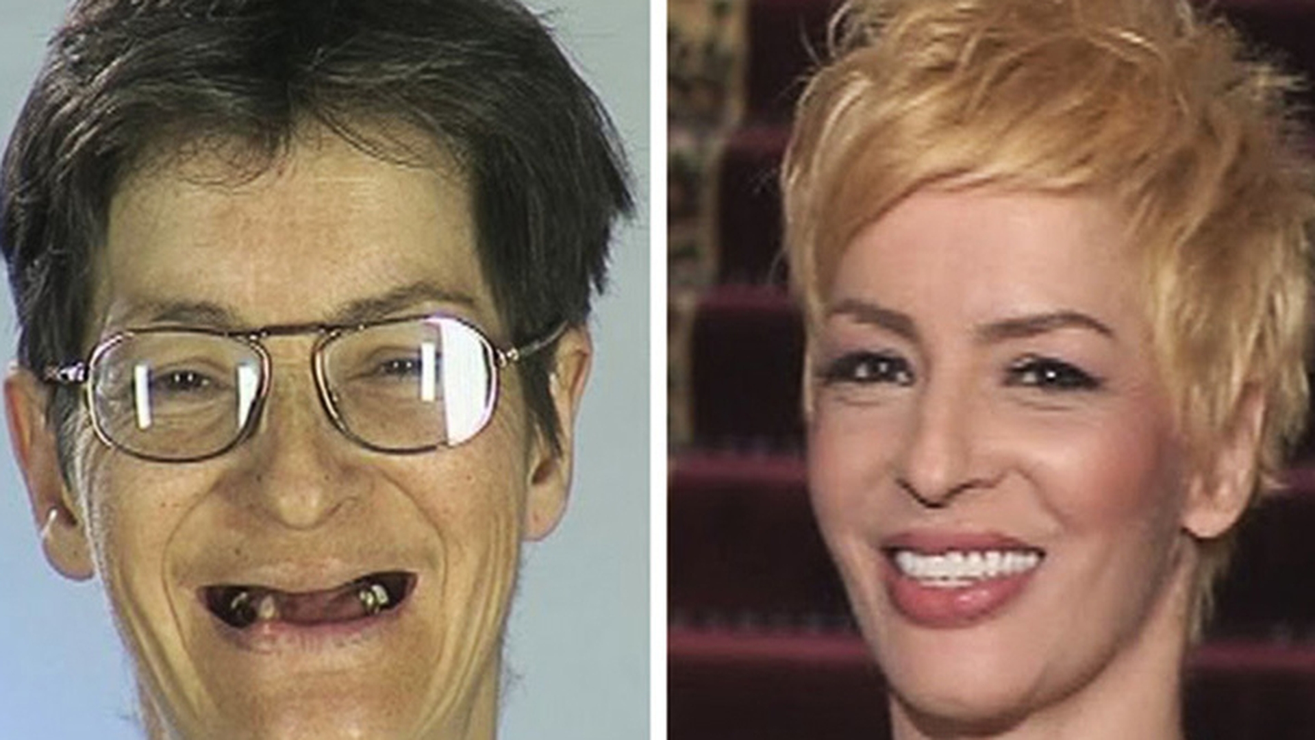 Cum arată acum LIGIA, la şase ani după transformarea incredibilă de la "Frumuseţe pe muchie de cuţit"! 
