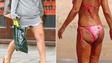 E deja pe piata! Medicamentul care previne Alzheimerul, dar te ajuta sa si slabesti